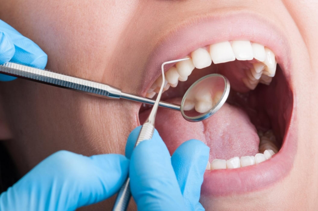 Causes and Treatment Options for Tooth Sensitivity